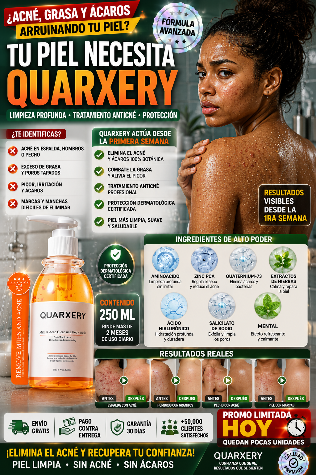 Gel Anti Acné Quarxery Limpia Piel Profundamente