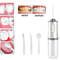 Irrigador Dental Recargable