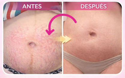 Crema ADEUS Reafirmante 300 gramos