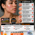 Gel Anti Acné Quarxery Limpia Piel Profundamente