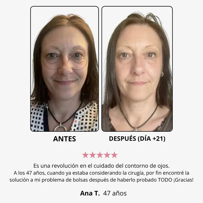 Crema de Ojos de Masaje Electrico YCZ