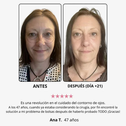 Crema de Ojos de Masaje Electrico YCZ