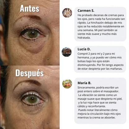 Crema de Ojos de Masaje Electrico YCZ