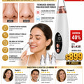 Removedor De Imperfecciones - imagen 1