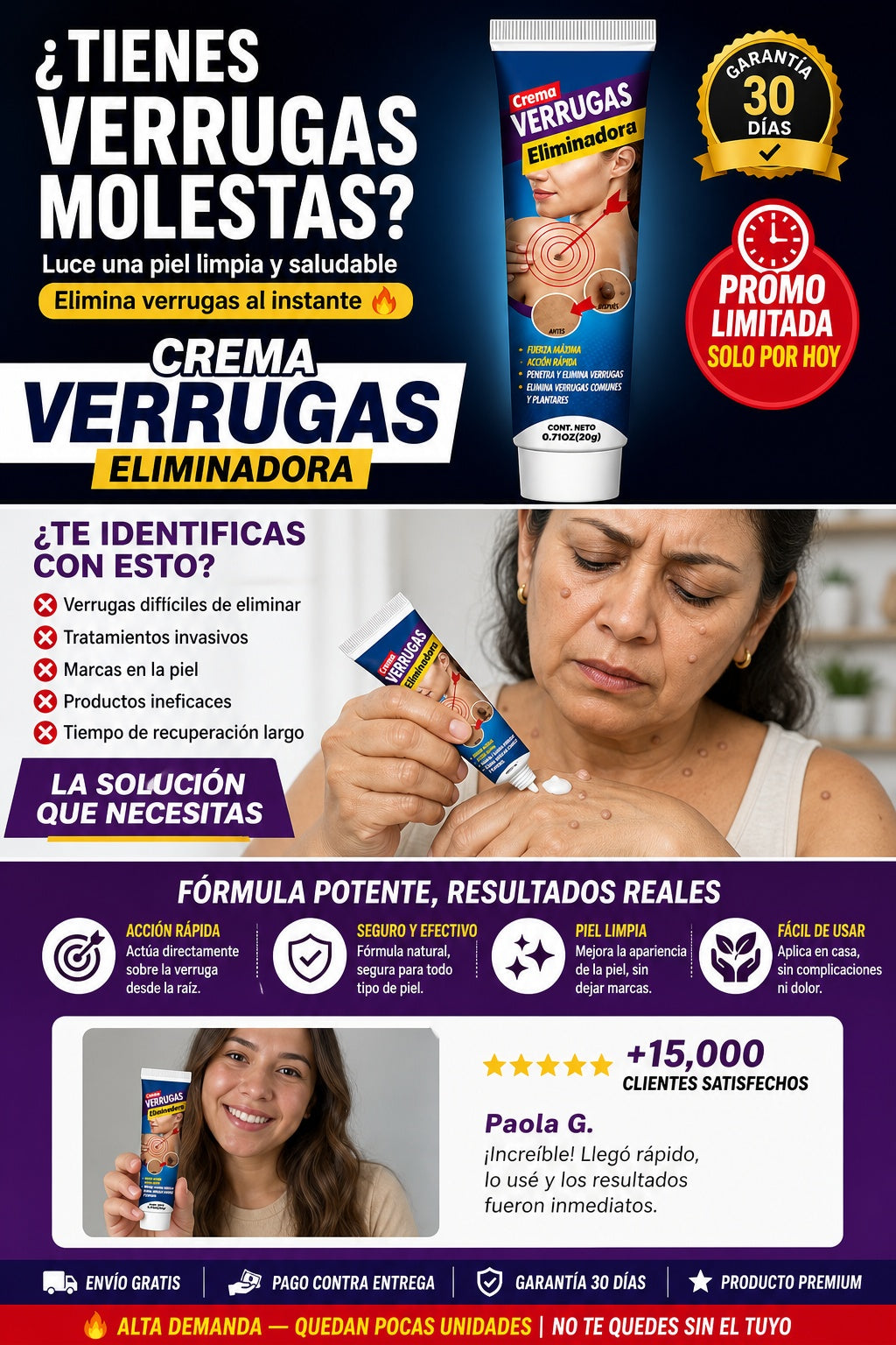 Crema Para Eliminar Verrugas - imagen 3