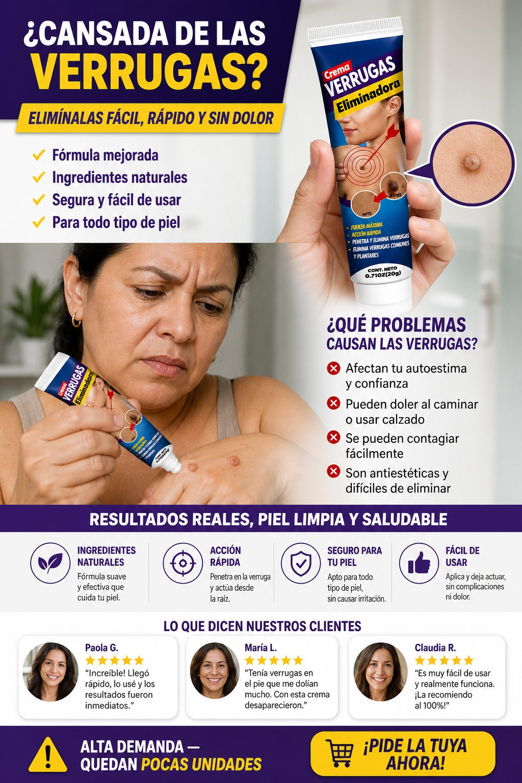Crema Para Eliminar Verrugas - imagen 3