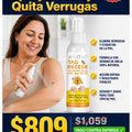 Spray De Abeja Quita Verrugas - imagen 3