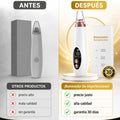 Removedor De Imperfecciones - imagen 4