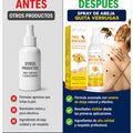 Spray De Abeja Quita Verrugas - imagen 4