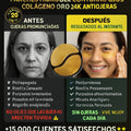 Parches hidrogel contorno ojos colágeno oro 24K antiojeras - imagen 4
