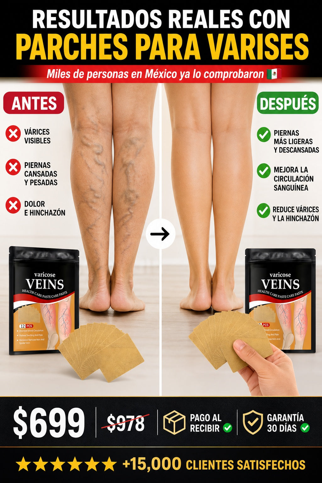 parches para varises - imagen 4