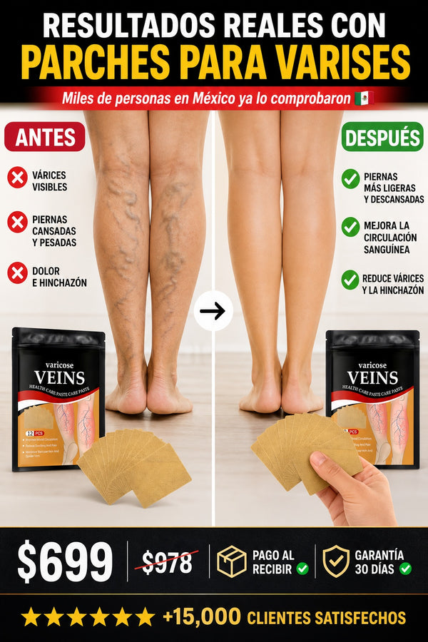 parches para varises - imagen 4