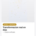 Irrigador Dental Recargable — antes-despues