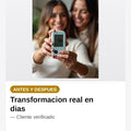 Glucometro Digital Blood Mati — antes-despues