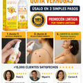 Spray De Abeja Quita Verrugas - imagen 8