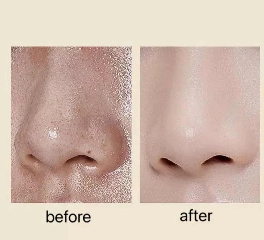 Kit Exfoliante Dr. Melaxin