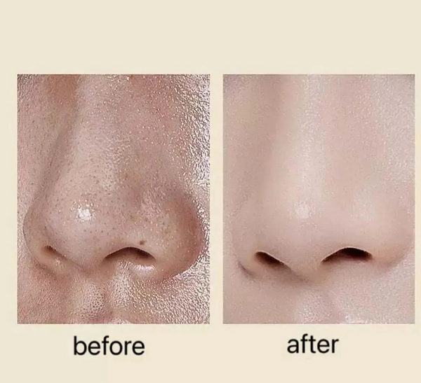 Kit Exfoliante Dr. Melaxin