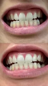 Blanqueador Dental Pasta Morada